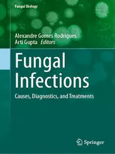 Fungal Infections Causes, Diagnostics, and Treatments