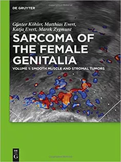 Smooth Muscle and Stromal Tumors and Prevention of Inadequate Surgery
