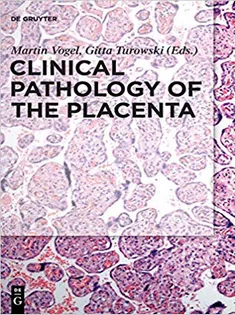 Clinical Pathology of the Placenta