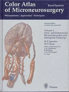 Color Atlas of Microneurosurgery