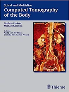 Spiral and Multislice Computed Tomography of the Body