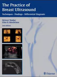 The Practice Of Breast Ultrasound