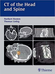 CT of the Head and Spine
