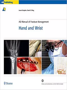 AO Manual of Fracture Management: Hand and Wrist
