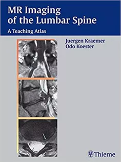 MRI of the Lumbar Spine: A Teaching Atlas