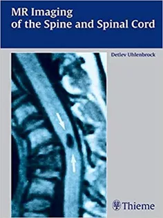 Mr Imaging of the Spine and Spinal Cord