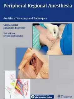 Peripheral Regional Anesthesia