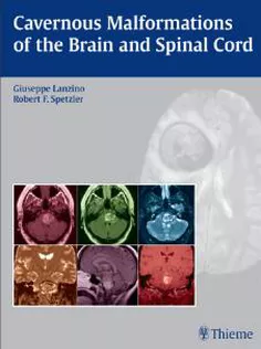 Cavernous Malformatios Of The Brain And Spinal Cord