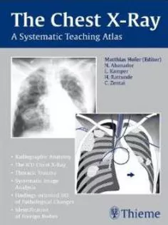 Chest X-ray Trainer