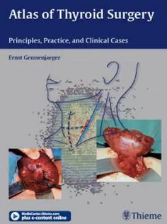 Atlas Of Thyroid Surgery
