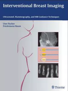 Interventional Breast Imaging