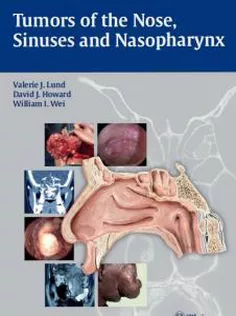 Tumors of the Nose, Sinuses and Nasopharynx