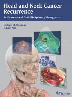 Head and Neck Cancer Recurrence