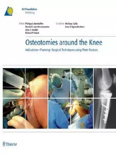 Osteotomies Around The Knee