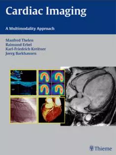 Cardiac Imaging: A Multimodality Approach