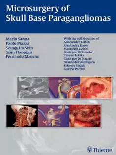 Microsurgery of Skull Base Paragangliomas