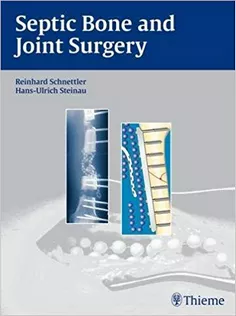 Septic Bone And Joint Surgery