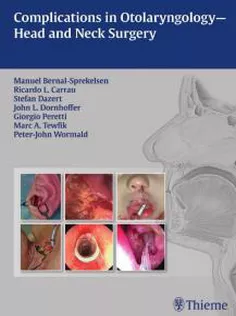Complications in Otolaryngology-Head and Neck Surgery