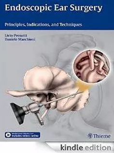 Endoscopic Ear Surgery