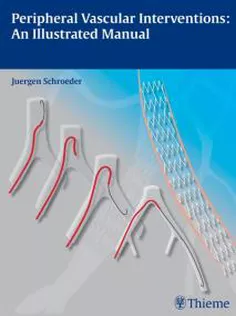 Peripheral Vascular Interventions: An Illustrated Manual