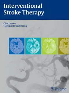 Interventional Stroke Therapy