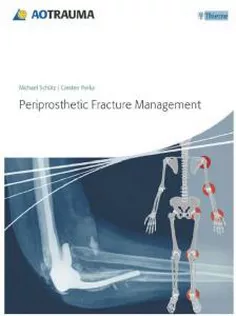 Periprosthetic Fracture Management