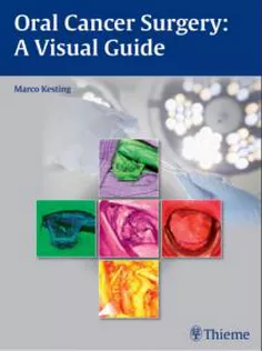 Oral Cancer Surgery: A Visual Guide