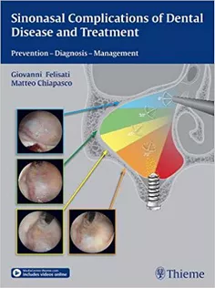 Sinonasal Complications of Dental Disease and Treatment