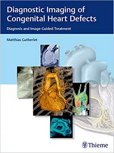 Diagnostic Imaging of Congenital Heart Defects