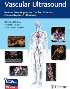 Vascular Ultrasound