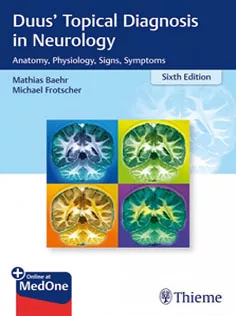 Duus' Topical Diagnosis in Neurology