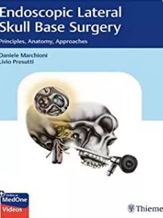Endoscopic Lateral Skull Base Surgery: Principles, Anatomy, Approaches