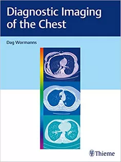 Diagnostic Imaging of the Chest