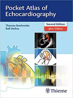 Pocket Atlas of Echocardiography