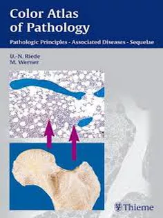 Color Atlas of Pathology Pathologic Principles, Associated Diseases, Sequela