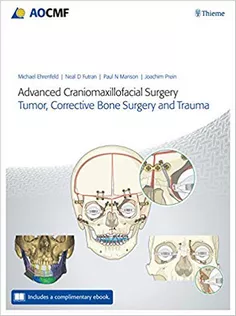 Advanced Craniomaxillofacial Surgery Tumor, Corrective Bone Surgery, and Trauma