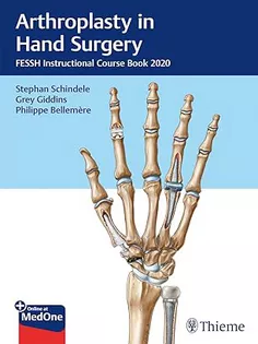 Arthroplasty in Hand Surgery: Fessh Instructional Course Book 2020