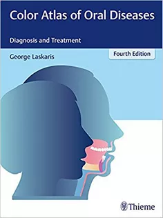 Color Atlas of Oral Diseases Diagnosis and Treatment
