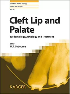 Cleft Lip and Palate: Epidemiology, Aetiology and Treatment