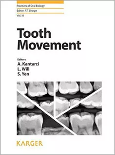 Tooth Movement