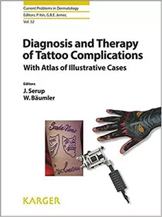 Diagnosis and Therapy of Tattoo ComplicationsWith Atlas of Illustrative Cases-With Atlas of Illustrative Cases