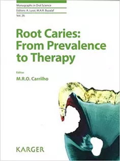 Root Caries: From Prevalence to Therapy