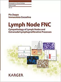 Lymph Node FNC