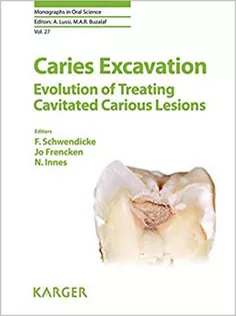 Caries Excavation: Evolution of Treating Cavitated Carious Lesions, Vol. 27