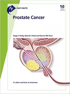 Fast Facts: Prostate Cancer: If, When and How to Intervene