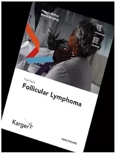 Fast Facts: Follicular Lymphoma