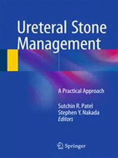 Ureteral Stone Management: A Practical Approach