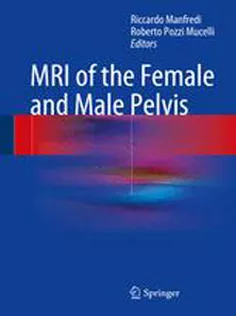 9783319096582 MRI of the Female and Male Pelvis