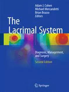 The Lacrimal System: Diagnosis, Management, and Surgery