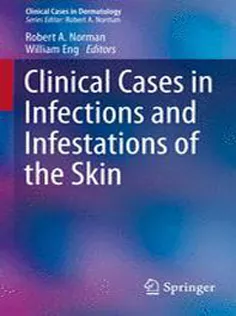 9783319142944 Clinical Cases in Infections and Infestations of the Skin